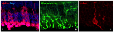 Transplantation of Adult Red fluorescent-iPSC derived photoreceptor precursor cells induces retinal outer nuclear layer repopulation. Immunocytochemical analysis performed on rhodopsin-null retinal degenerative eyes 21 days after receiving subretinal injections of iPSC derived photoreceptor precursor cells targeted against expression of the donor cell marker (dsRed A and C) and of the photoreceptor marker rhodopsin (B). Transplantation of Adult Red fluorescent-iPSC derived photoreceptor precursor cells induces retinal outer nuclear layer repopulation.