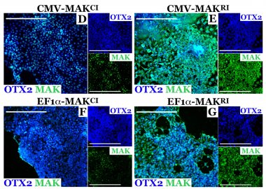 Evaluation of MAK isoforms in patient-derived photoreceptor precursors. Evaluation of MAK isoforms in patient-derived photoreceptor precursors.