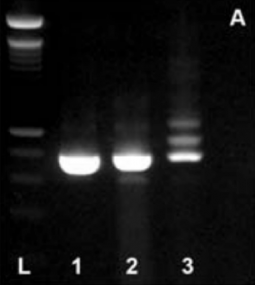 RT-PCR analysis of ABCA4 in RNA extracted from human control retina (lane 1), human keratinocytes isolated from an unaffected individual (lane 2), and human keratinocytes isolated from a patient with ABCA4 associated retinal degeneration (lane 3). An intronic splice site mutations in IVS 36 of the ABCA4 gene result in the introduction of an alternate exon (36.1). RT-PCR analysis of ABCA4 in RNA extracted from human control retina (lane 1), human keratinocytes isolated from an unaffected individual (lane 2), and human keratinocytes isolated from a patient with ABCA4 associated retinal degeneration (lane 3). An intronic splice site mutations in IVS 36 of the ABCA4 gene result in the introduction of an alternate exon (36.1).